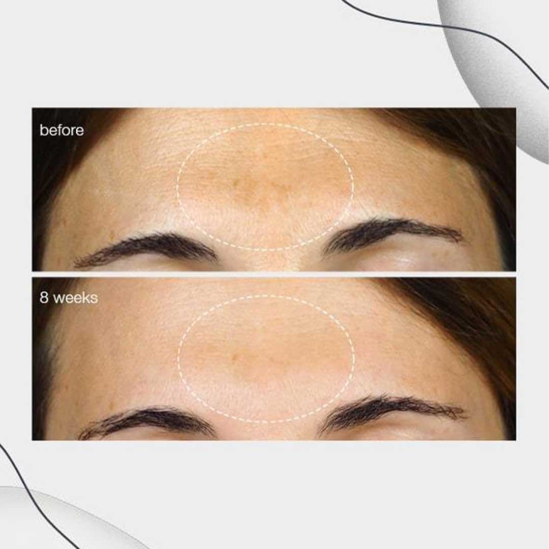 dermalogica powerbright dark spot serum, 30ml