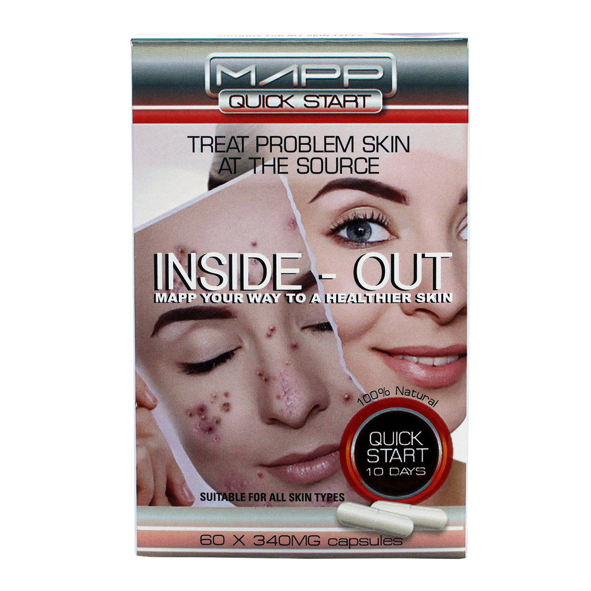 MAPP Quick Start Intensive Treatment 340mg Capsules, 60's