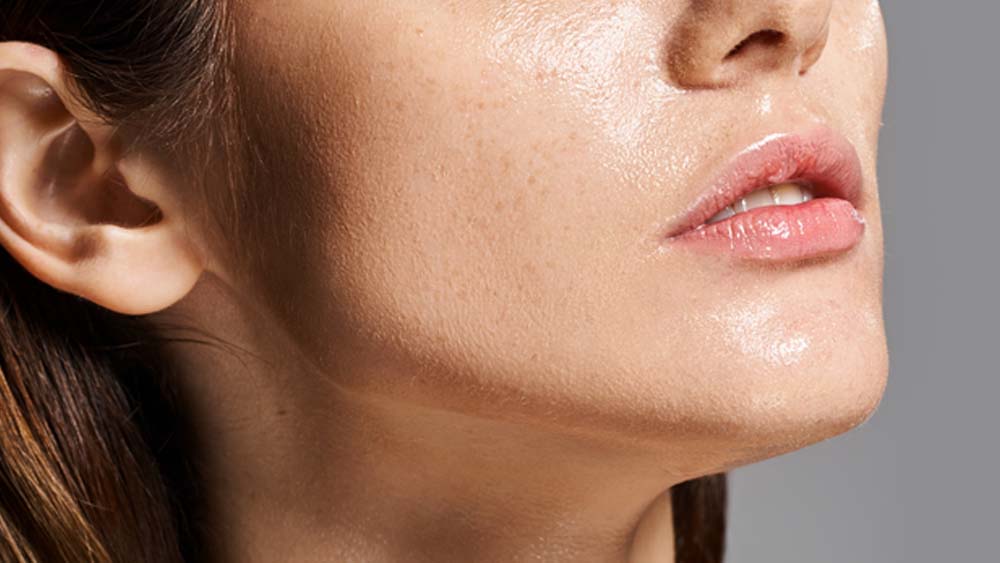 Combating Oily Skin: Your Ultimate Guide