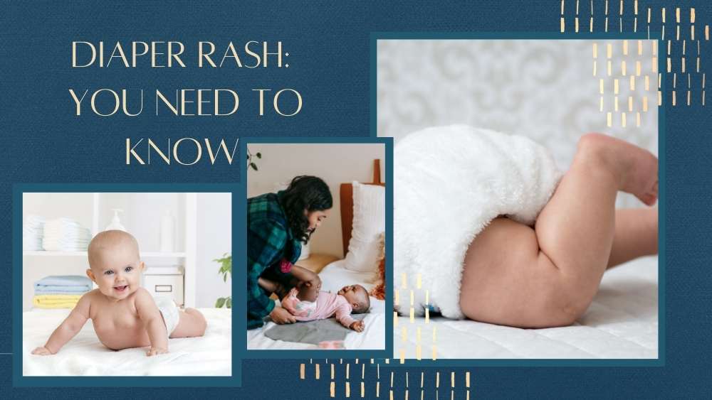 Diaper Rash: You Need to Know!