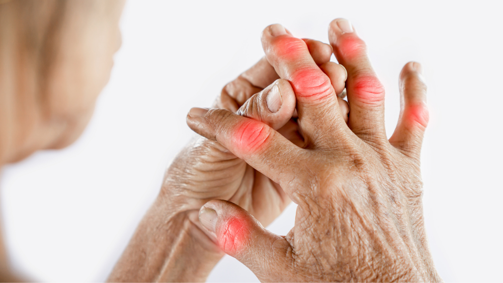 15 Superfoods That Help Manage Gout Naturally:   A Rheumatologist’s Guide