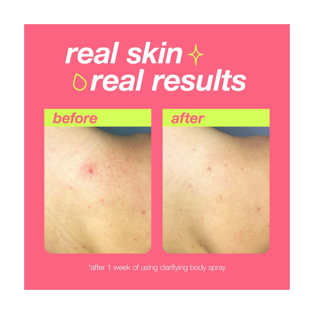 Dermalogica Clear Start Clarifying Body Spray, 177ml